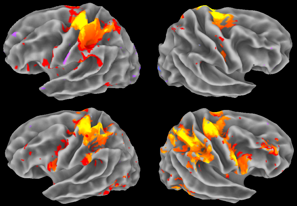 fMRI Image
